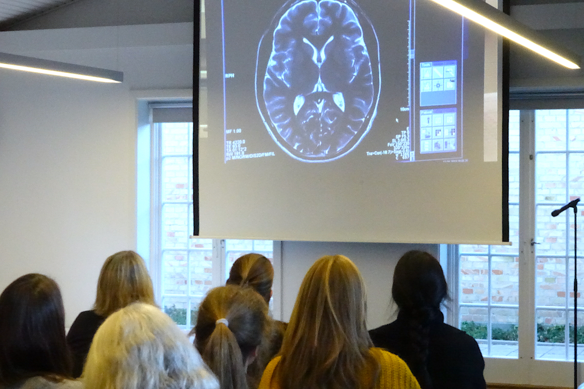 Fagpersoner Hjerne Neuroplasticitet WEB